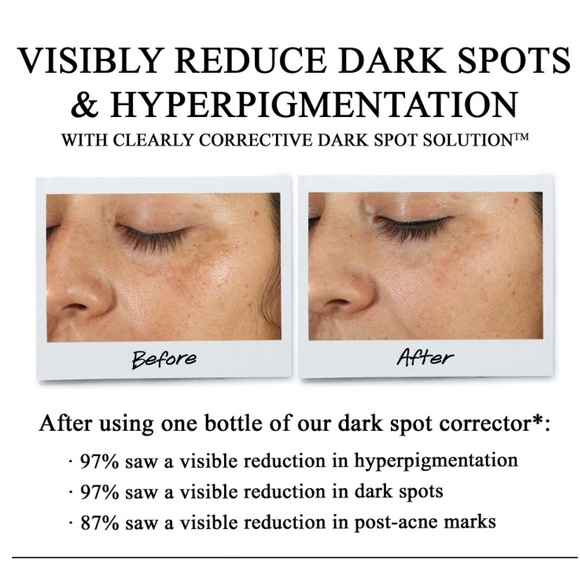 Kiehl’s Clearly Corrective Dark Spot Serum - Picture 5 of 10